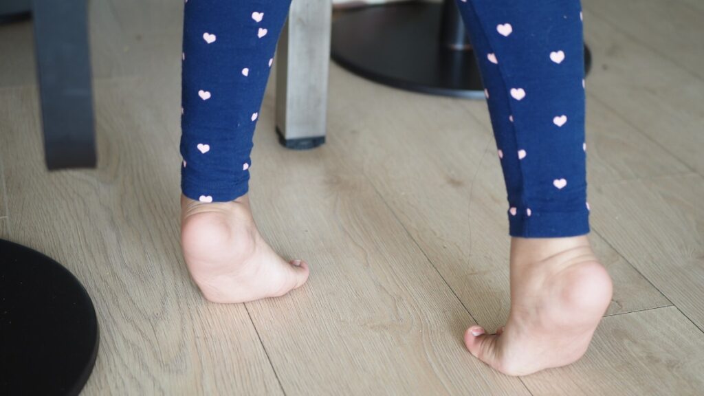 gait abnormalities in kids with autism 1